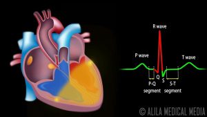 Cardiac Conduction System and Understanding ECG, Animation.
