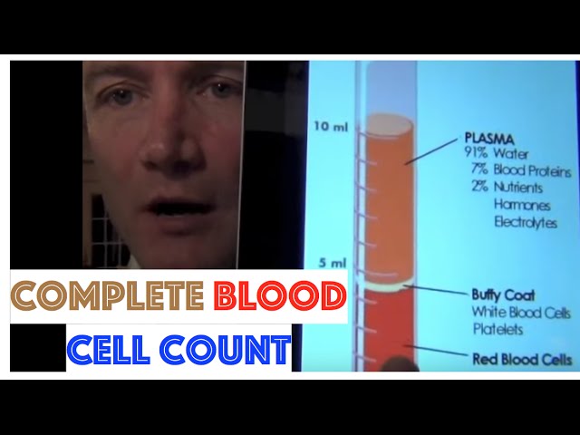 You are currently viewing Complete Blood Cell Count