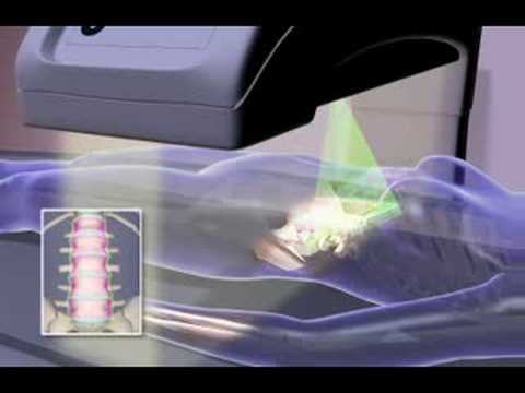 You are currently viewing DEXA – Dual Energy X-Ray Absorptiometry