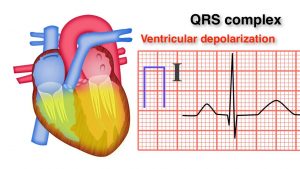 Read more about the article ECG Basics 8/10 – QRS Complex