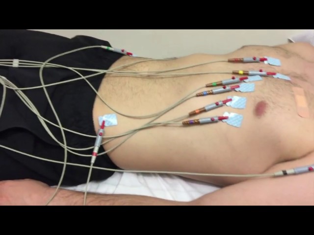 You are currently viewing ECG – Electrocardiogram