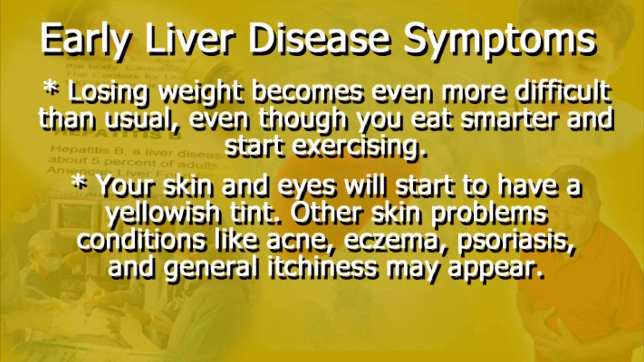 You are currently viewing Early Liver Disease Symptoms