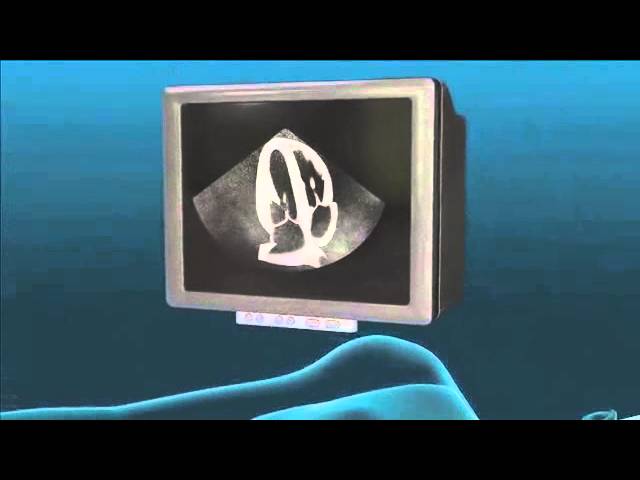 You are currently viewing Echocardiogram Animation