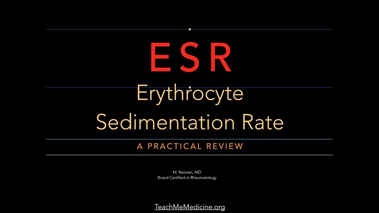 You are currently viewing Erythrocyte Sedimentation Rate (ESR)