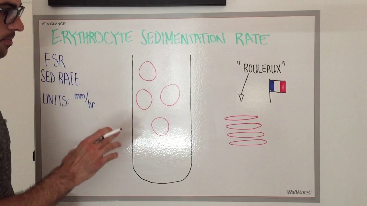 You are currently viewing Erythrocyte Sedimentation Rate: Explained