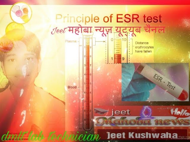 You are currently viewing Esr test full procedure