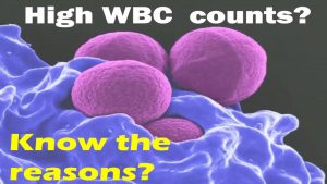 Read more about the article HIGH WBC COUNT | Reasons of high white blood cell count | WBC count normal range | High WBC level