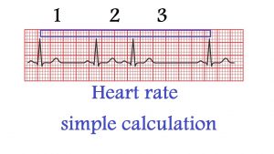 How do you calculate heart rate from ECG?