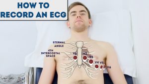 Read more about the article How to record an ECG – OSCE Guide