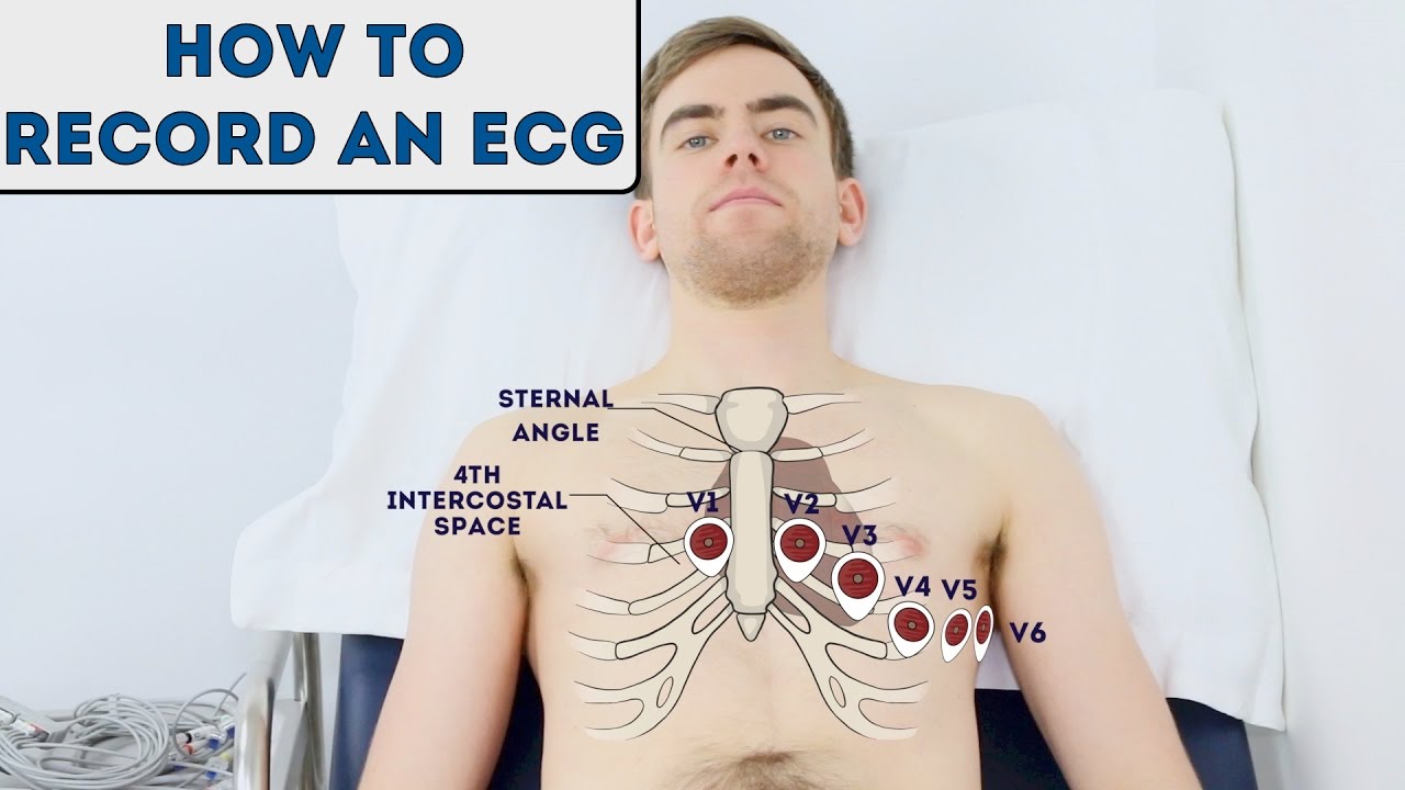 You are currently viewing How to record an ECG – OSCE Guide