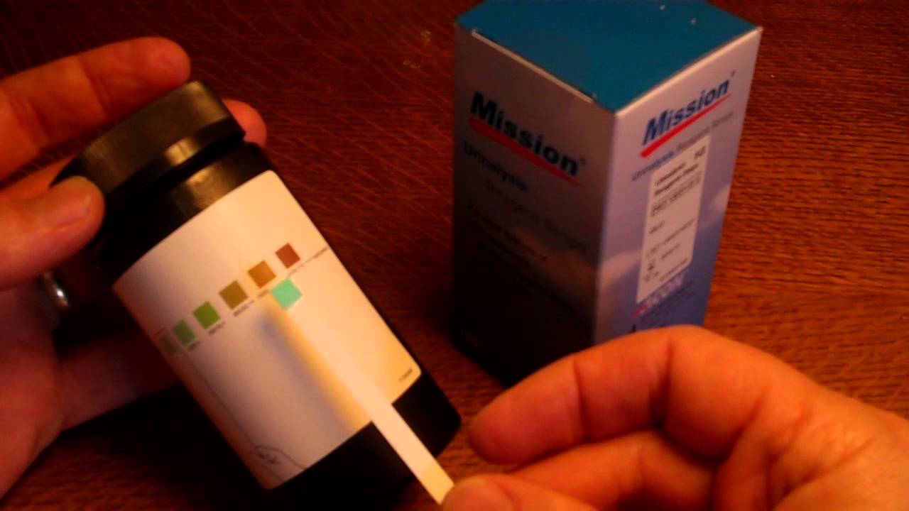 You are currently viewing How to test for Diabetes Type 2 -a quick urine test for diabetes