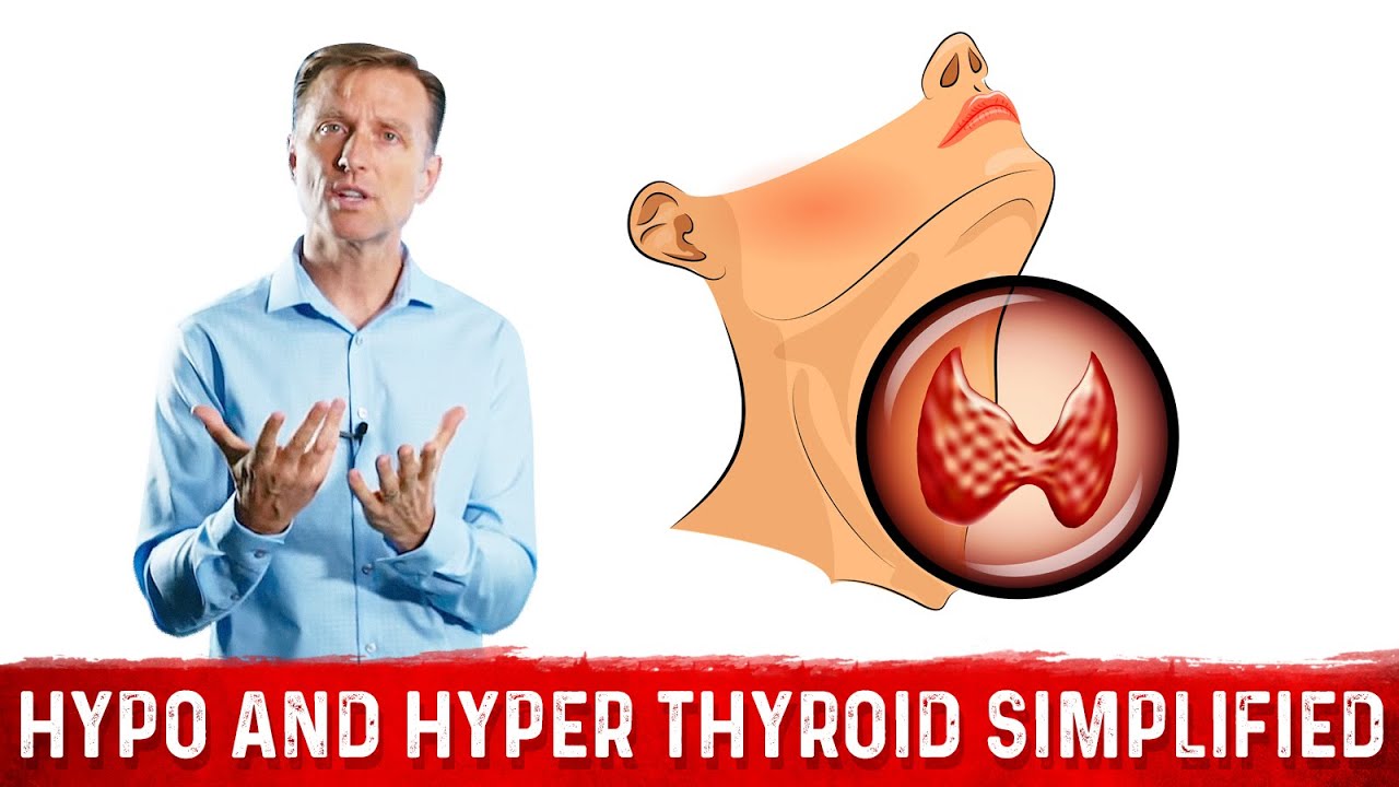 You are currently viewing Hyperthyroid vs Hypothyroid Explained By Dr.Berg