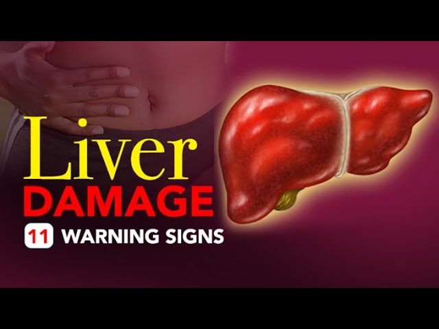 You are currently viewing Liver Damage – 11 Warning Signs