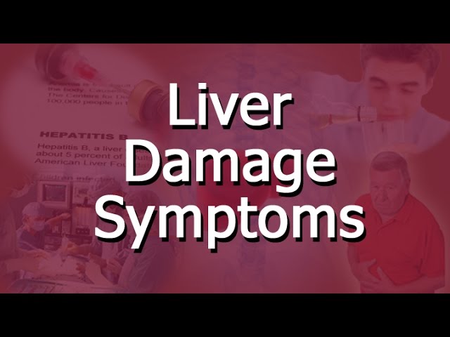 You are currently viewing Liver Damage Symptoms