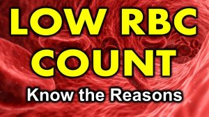 Read more about the article Low RBC count??? What are the reasons??? | causes of low RBC | Low Red blood cell count reasons