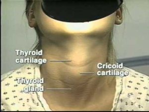 Lymph node, thyroid examination