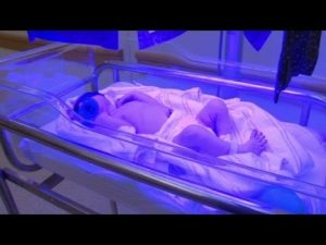 Read more about the article Newborn Jaundice