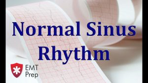 Normal Sinus Rhythm ECG – EMTprep.com