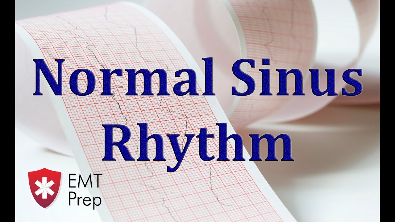 You are currently viewing Normal Sinus Rhythm ECG – EMTprep.com