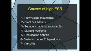 Read more about the article Notes on ESR  Part 1