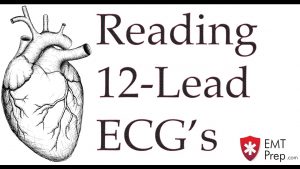 Read more about the article Reading 12-Lead ECG’s – EMTprep.com