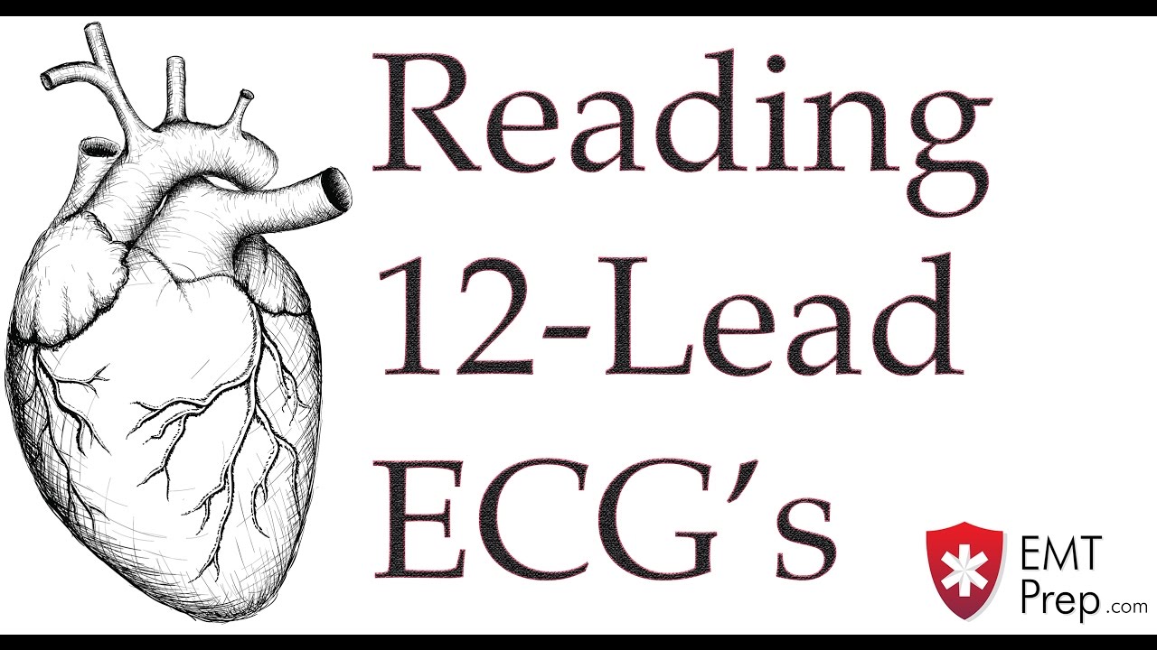 You are currently viewing Reading 12-Lead ECG’s – EMTprep.com