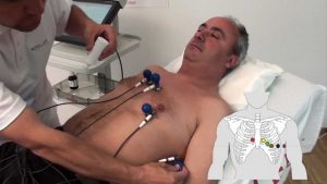 Read more about the article SCHILLER electrode placement for resting ECG with standard electrode set
