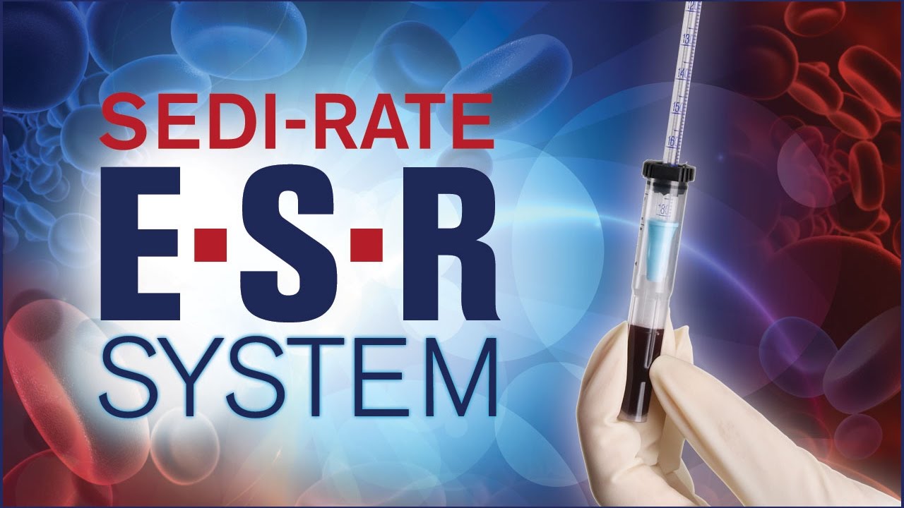 You are currently viewing Sedi-Rate ESR System from Globe Scientific