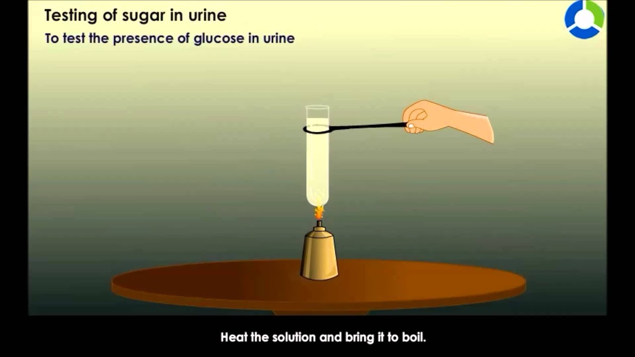 You are currently viewing Testing of Sugar in Urine – Transportation in Animals and Plants (CBSE Grade 07 Biology)