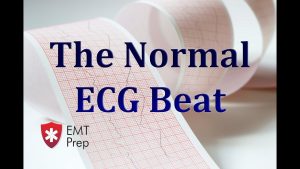 Read more about the article The Normal ECG Beat – EMTprep.com