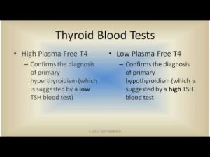 Read more about the article Thyroid Blood Tests