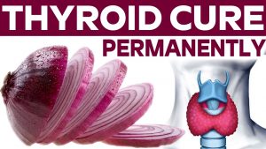 Thyroid Cure Permanently With in Week – Thyroid Free for Raw Onion