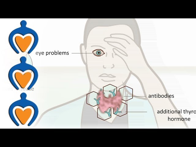 You are currently viewing Thyroid problems – most common thyroid problems, symptoms and treatment