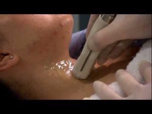 Ultrasound Training: Thyroid and Parathyroid Glands