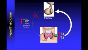 Read more about the article Understanding Thyroid Function Tests