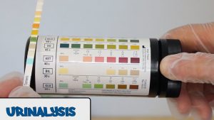 Read more about the article Urinalysis – OSCE Guide