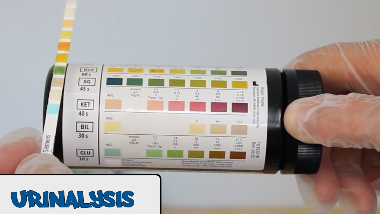 You are currently viewing Urinalysis – OSCE Guide