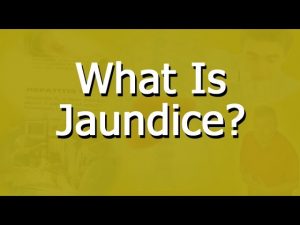 Read more about the article What Is Jaundice?