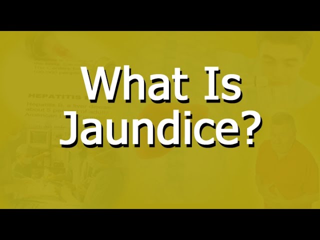 You are currently viewing What Is Jaundice?