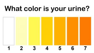 What The Color of Your Urine Says About Your Health