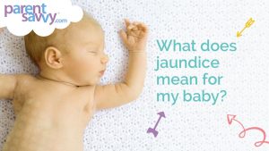 Read more about the article What is Jaundice?