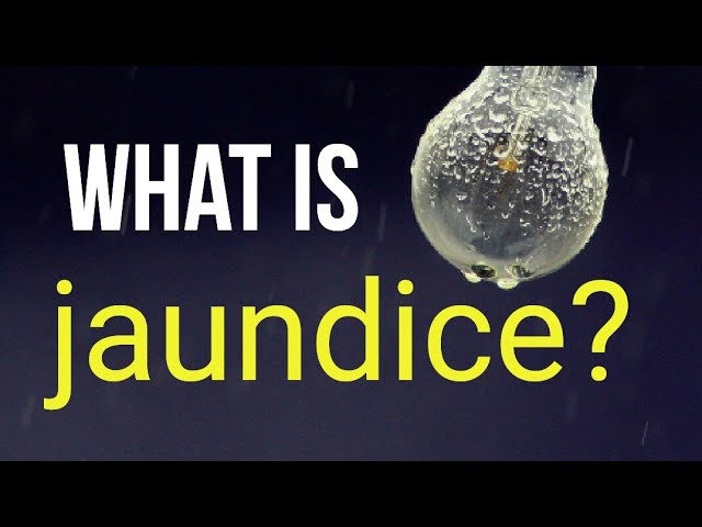 You are currently viewing What is jaundice?