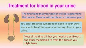 What is the Cause for Blood in Urine – Hoool.com