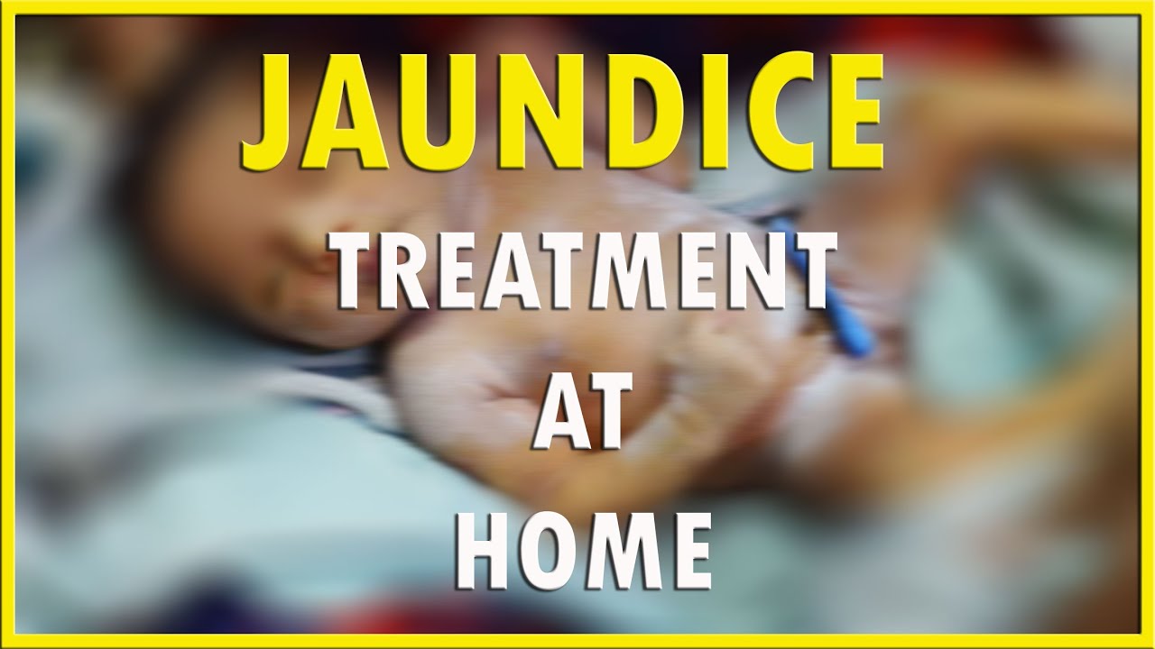 You are currently viewing how to cure jaundice in newborn baby ?  HD 1080P