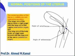 23 Pelvis Normal Positions of Uterus