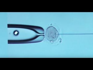 5 steps to in vitro fertilization