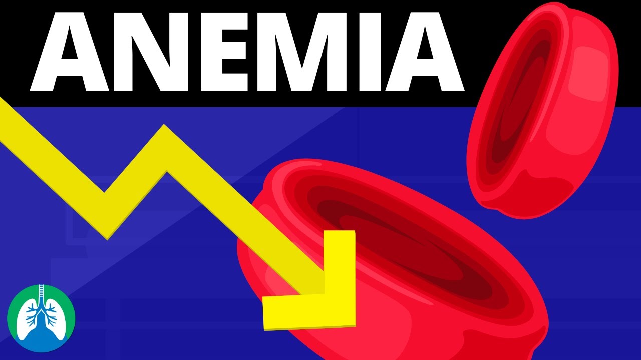 You are currently viewing Anemia (Medical Definition) | Quick Explainer Video