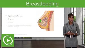 Read more about the article Breastfeeding and Common Breast Conditions – Obstetrics | Lecturio