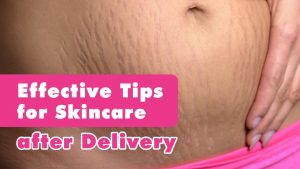Effective Skincare Tips After Delivery