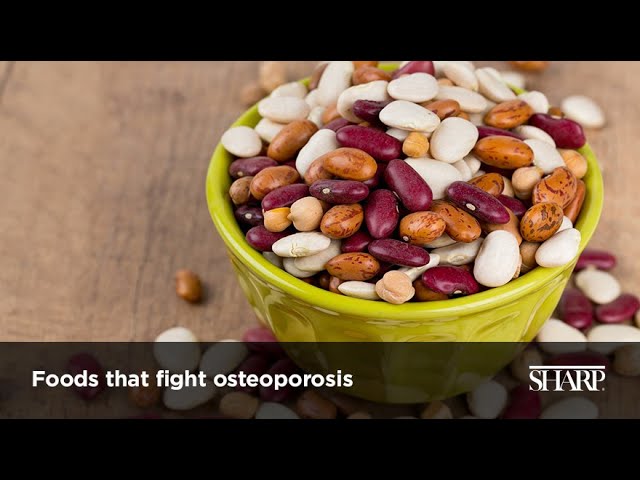 You are currently viewing Foods that Fight Osteoporosis